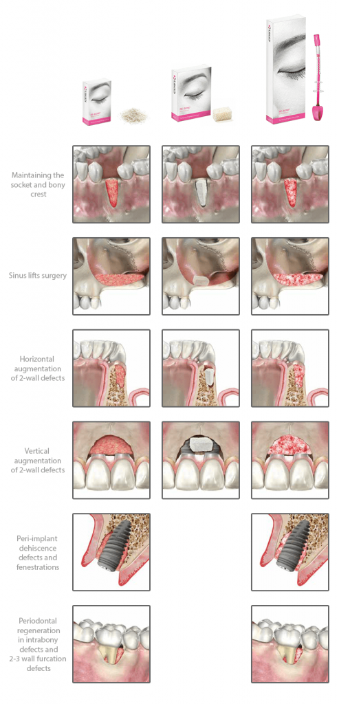 f93aa2e163-applicazioni-cliniche-rebone-en